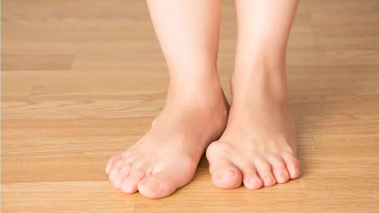 Foot Deformities