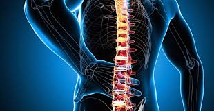 What is Kyphosis Treatment?