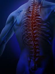 What is Kyphosis Treatment?